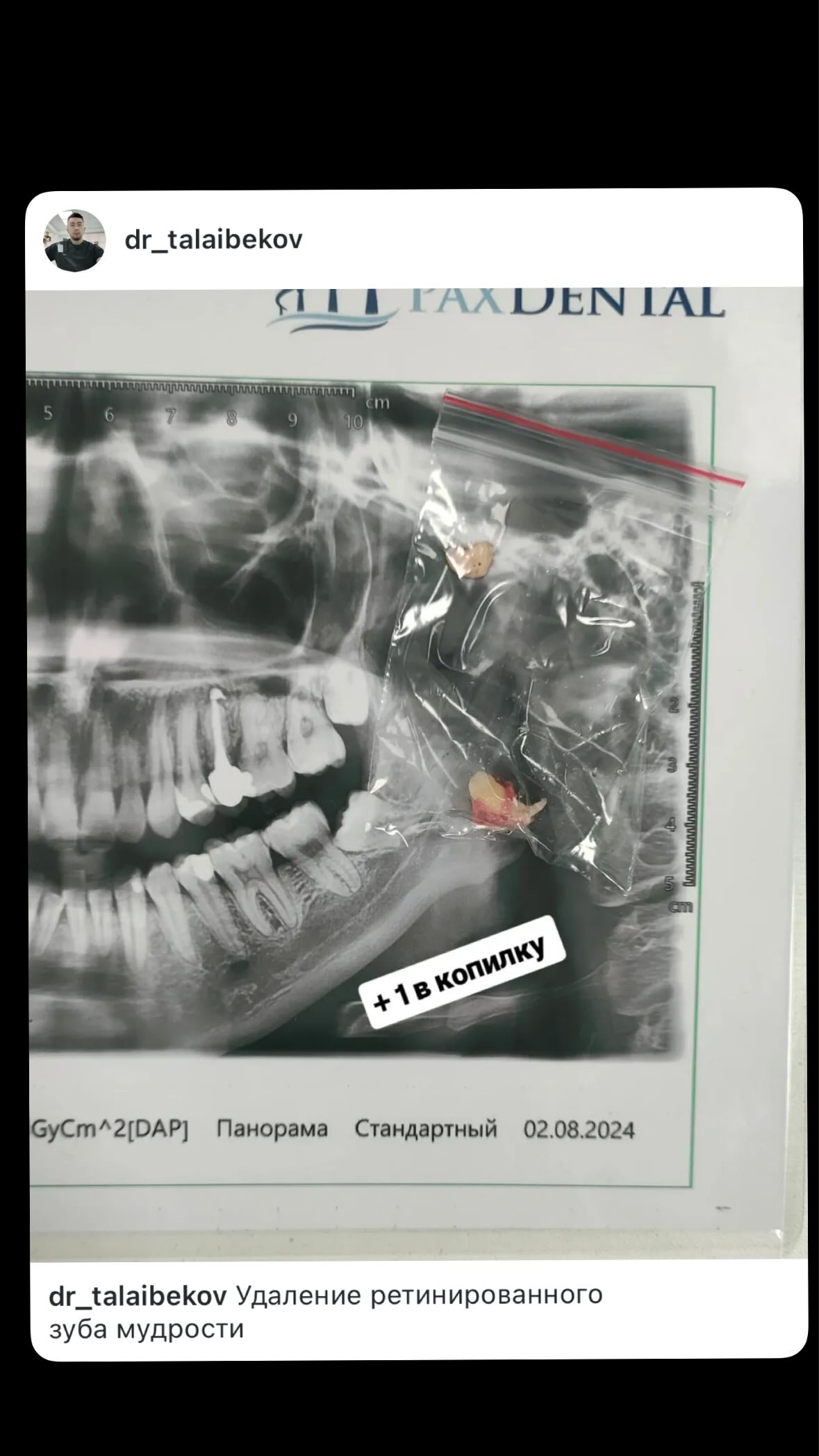 Послеоперационный уход