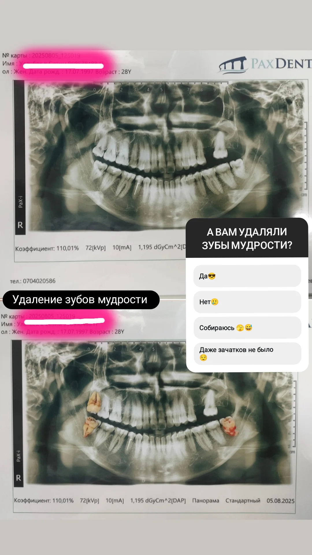 Хирургия — кейс 3