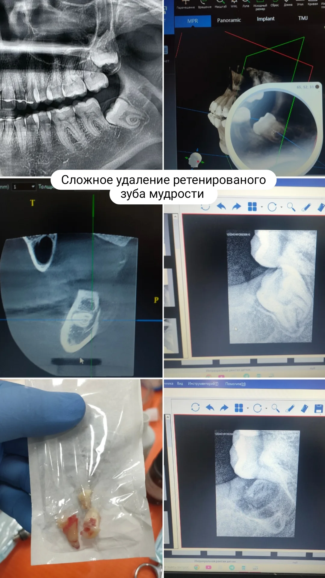 Хирургия — кейс 4