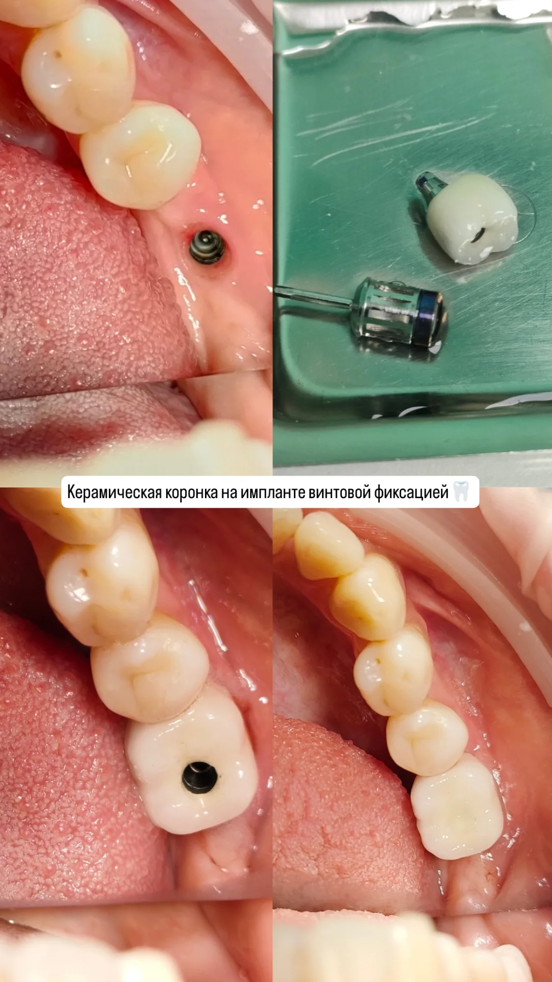 Ортопедия — кейс 1