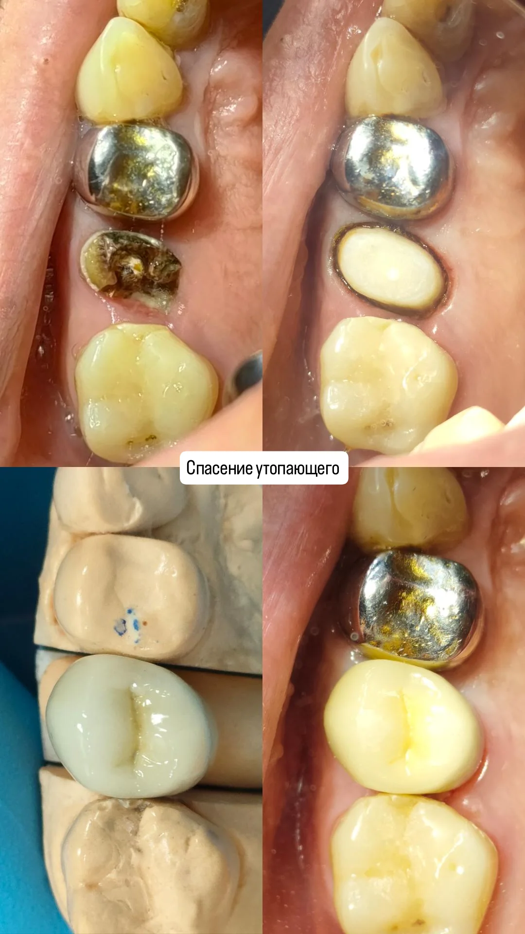 Ортопедия — кейс 2