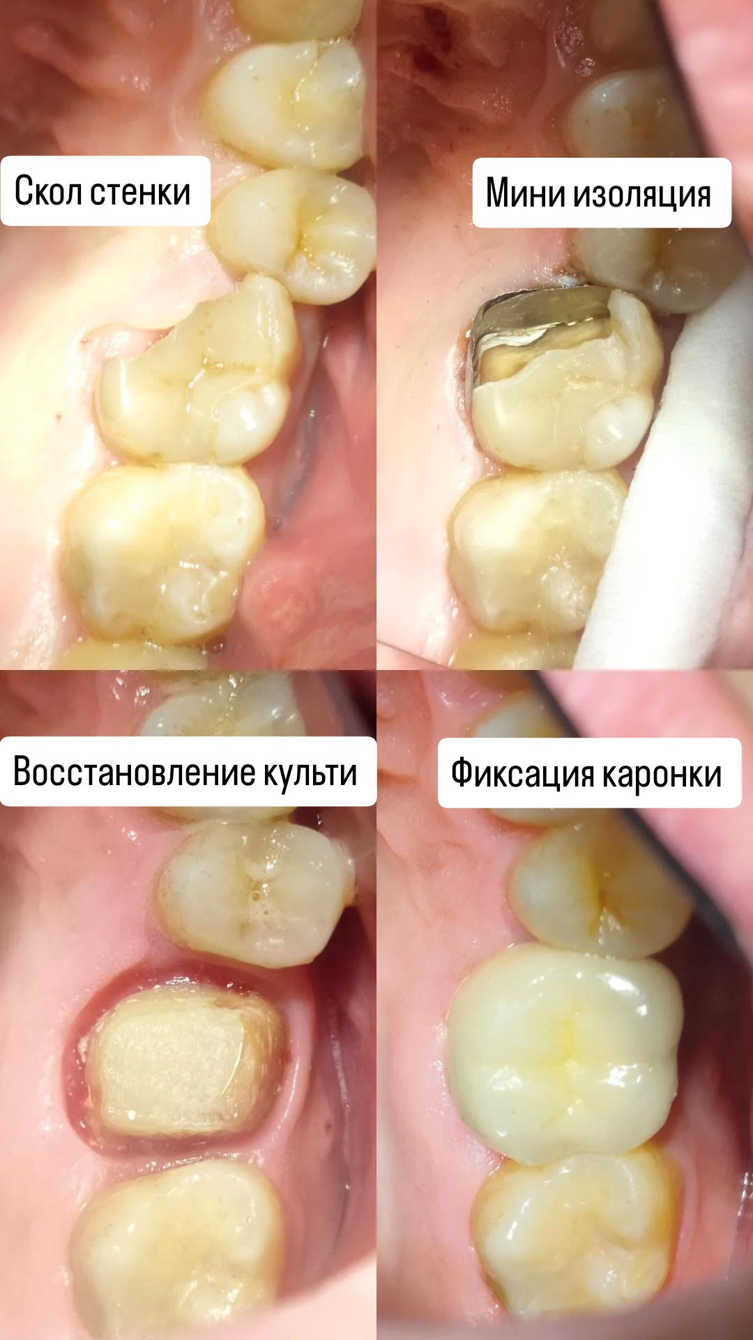 Ортопедия — кейс 3