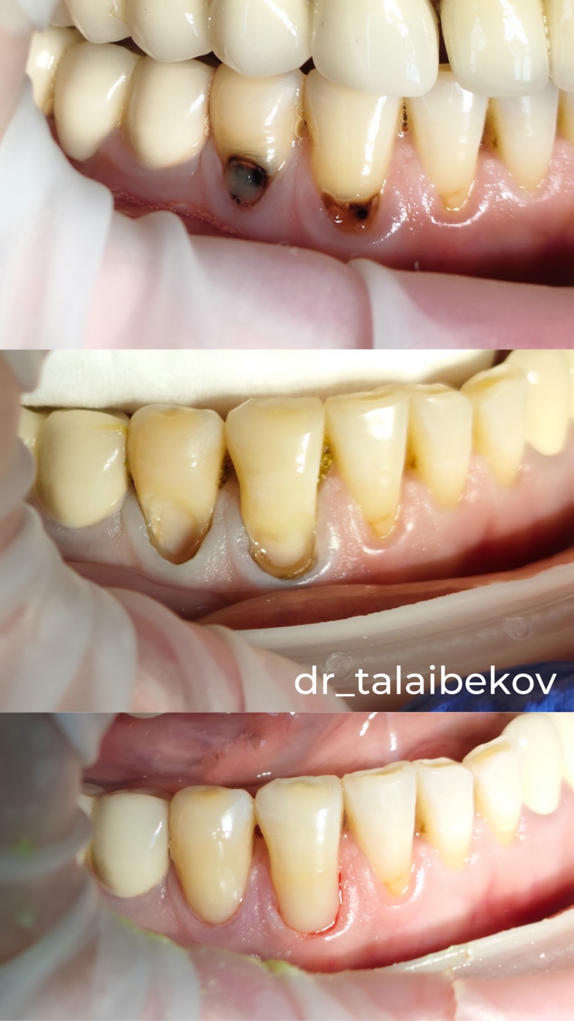 Терапия — кейс 1