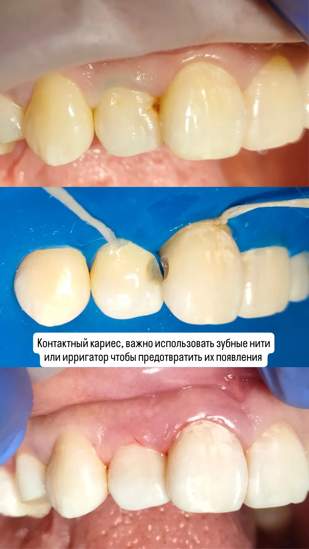 Терапия — кейс 2