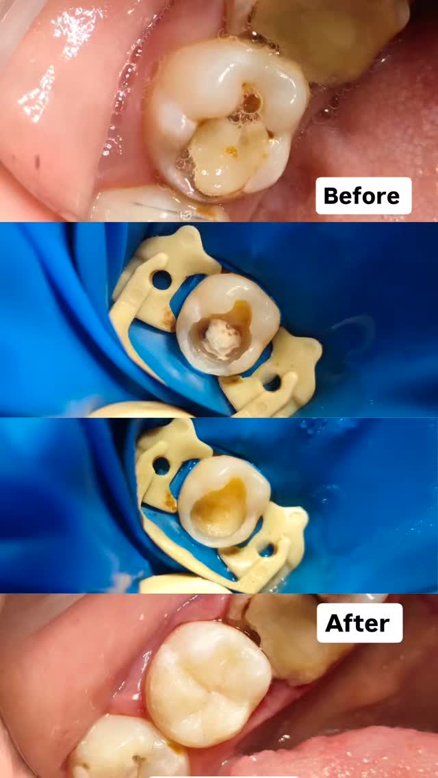 Терапия — кейс 3