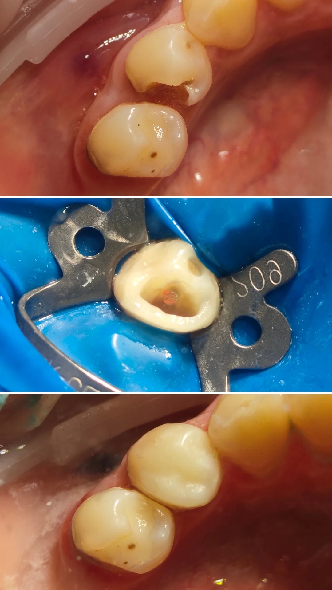 Терапия — кейс 4