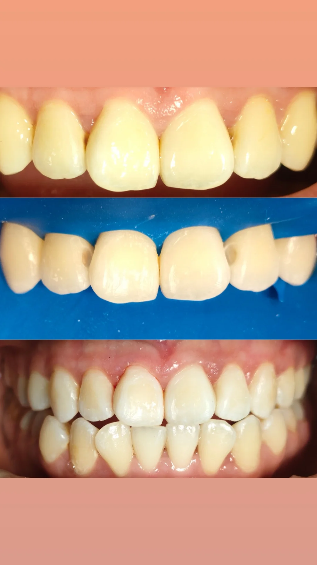 Терапия — кейс 5