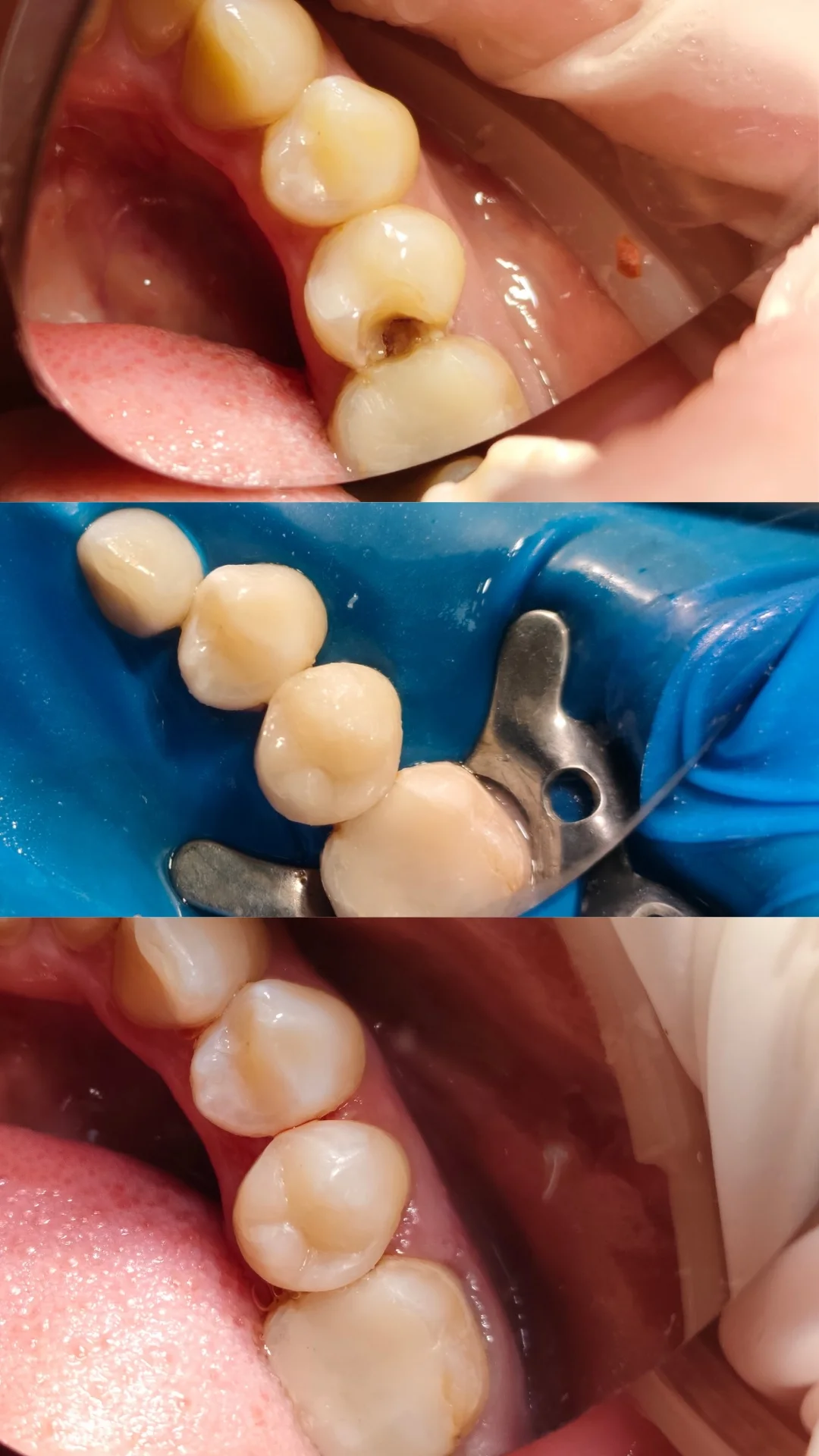 Терапия — кейс 6