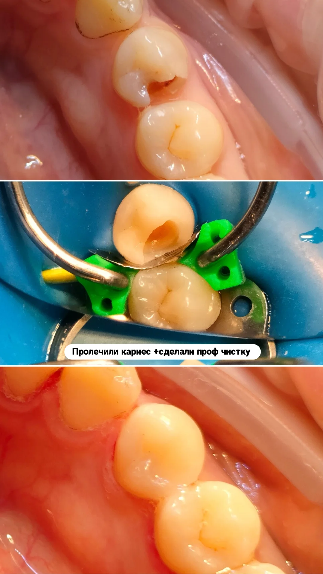 Терапия — кейс 7