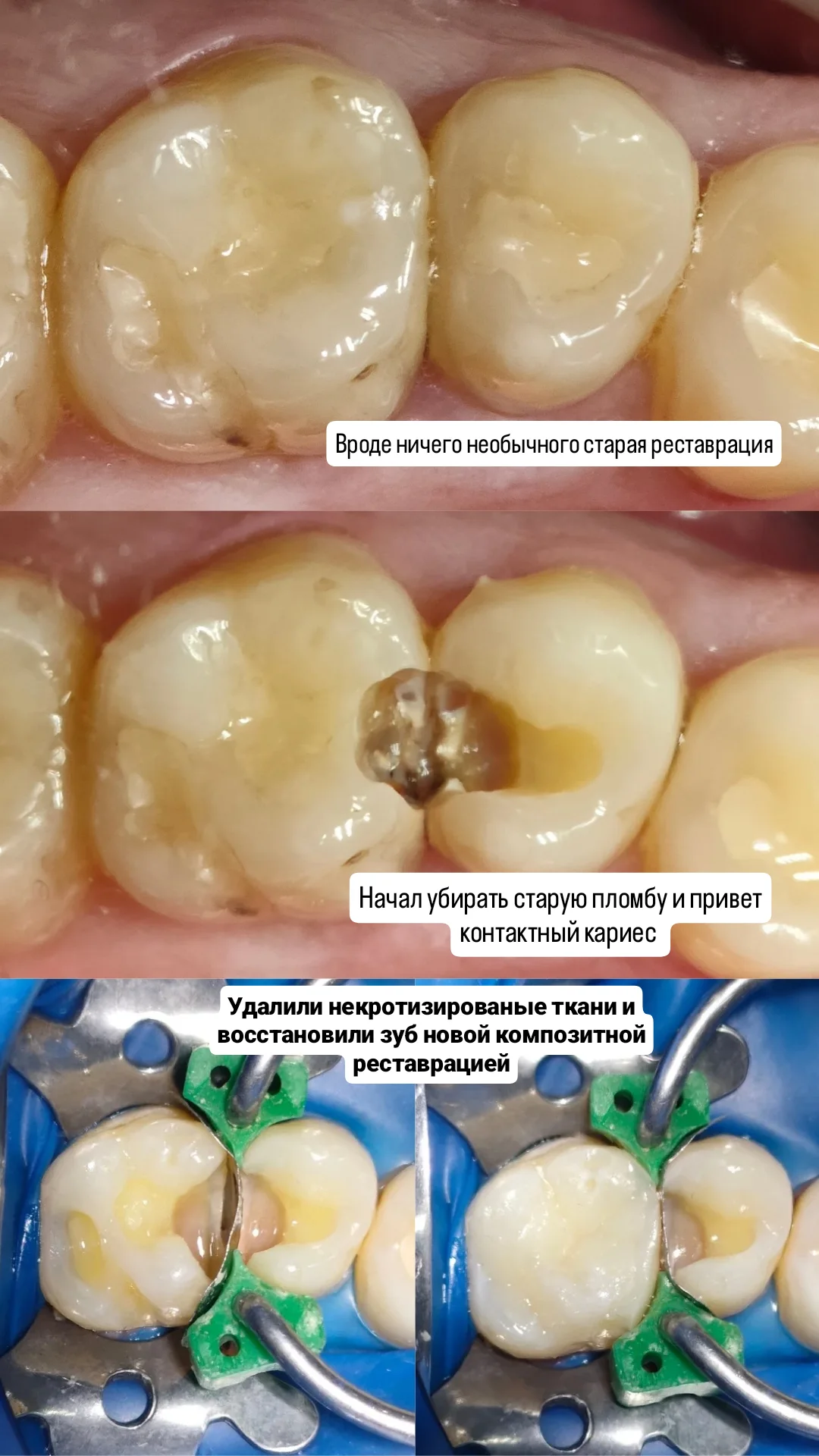 Терапия — кейс 8