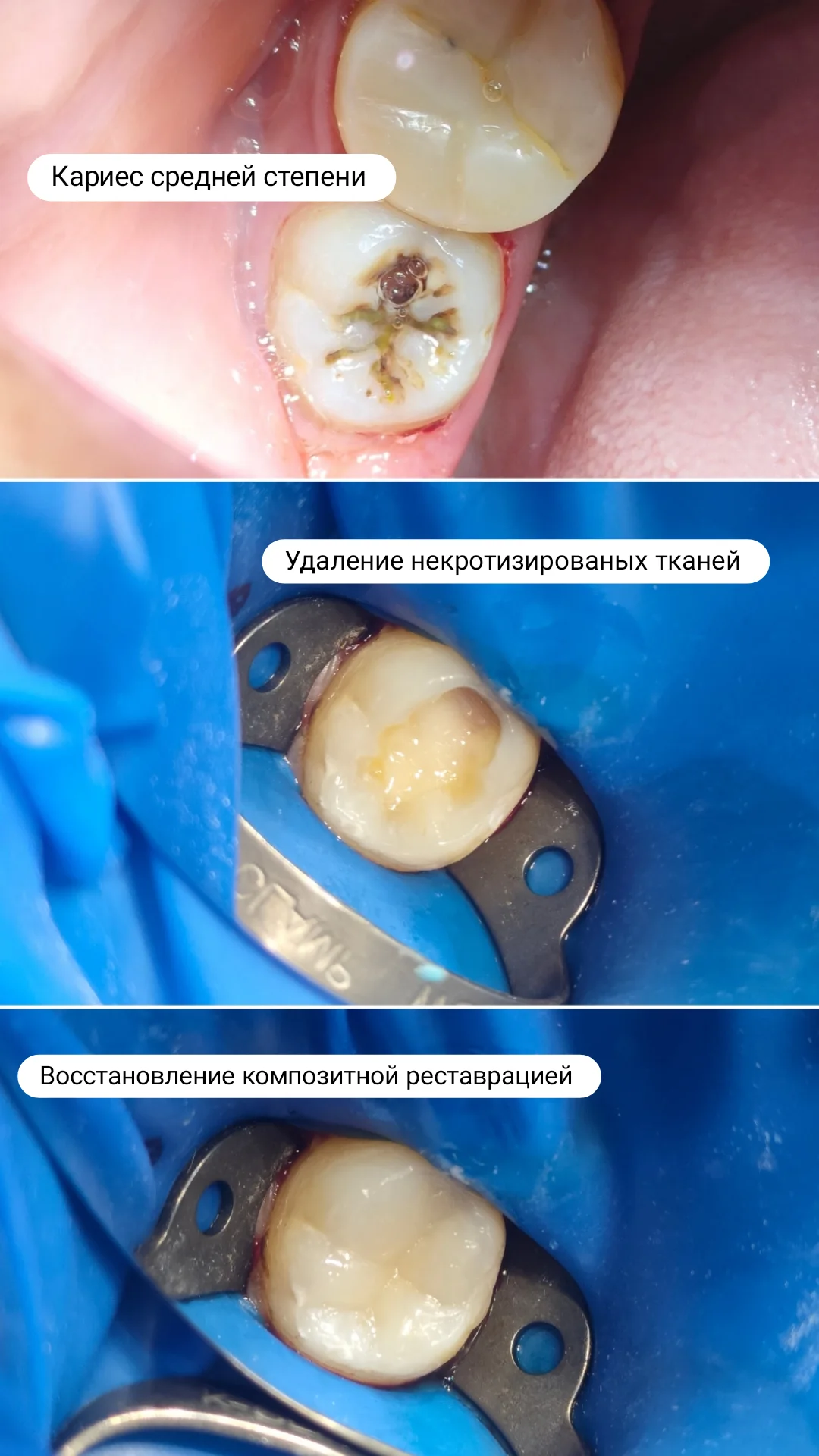 Терапия — кейс 9