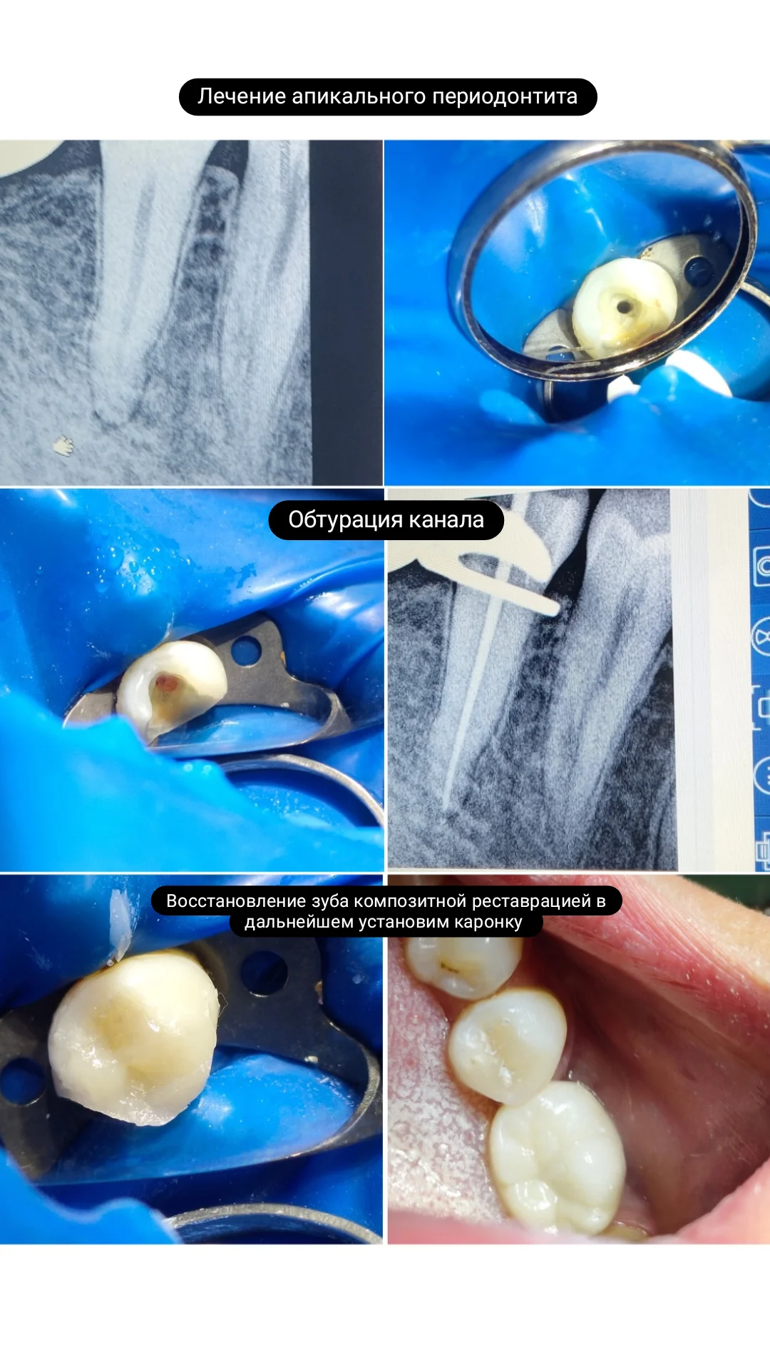 Эндодонтия